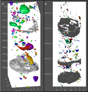 Heterogeneity at the core-scale showing development of vugs and cavities left by dissolved shells.